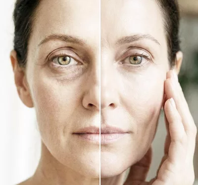 Rejuvenecedor de Ojeras