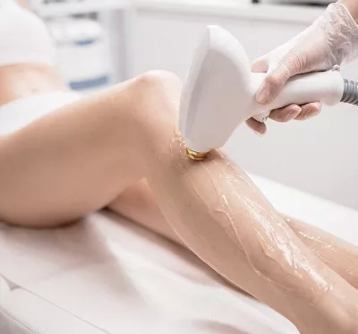 Depilación Láser de Diodo