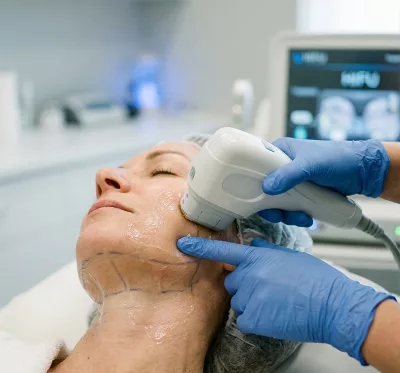 HIFU – Lifting Facial y Corporal