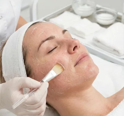 Peeling Estético + INDIBA